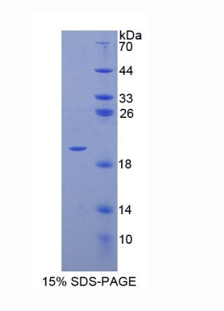 唾液酸结合Ig样凝集素9(SIGLEC9)重组蛋白,Recombinant Sialic Acid Binding Ig Like Lectin 9 (SIGLEC9)