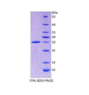 醛脫氫酶1家族成員A3(ALDH1A3)重組蛋白,Recombinant Aldehyde Dehydrogenase 1 Family, Member A3 (ALDH1A3)