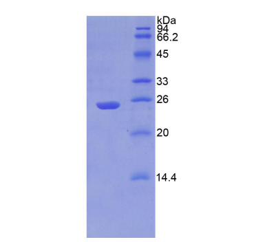 嘌呤霉素敏感性氨肽酶(PSA)重组蛋白,Recombinant Puromycin Sensitive Aminopeptidase (PSA)