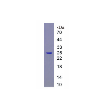 细胞分裂周期因子25B(CDC25B)重组蛋白,Recombinant Cell Division Cycle Protein 25B (CDC25B)