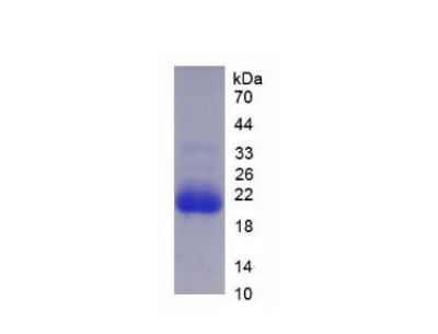 细胞色素P450家族成员3A7(CYP3A7)重组蛋白,Recombinant Cytochrome P450 3A7 (CYP3A7)