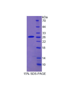 细胞色素P450家族成员2D6(CYP2D6)重组蛋白,Recombinant Cytochrome P450 2D6 (CYP2D6)