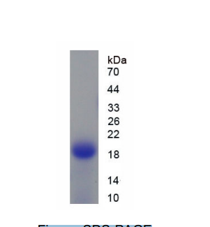 巨噬细胞集落刺激因子受体(MCSFR)重组蛋白,Recombinant Colony Stimulating Factor Receptor, Macrophage (MCSFR)