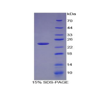 趋化因子C-X-C-基元配体15(CXCL15)重组蛋白,Recombinant Chemokine C-X-C-Motif Ligand 15 (CXCL15)