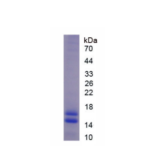 衰老關(guān)鍵蛋白5(FBLN5)重組蛋白,Recombinant Fibulin 5 (FBLN5)