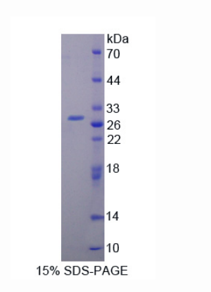 催乳素受体(PRLR)重组蛋白,Recombinant Prolactin Receptor (PRLR)