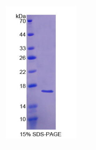 激活素A受体Ⅰ(ACVR1)重组蛋白,Recombinant Activin A Receptor Type I (ACVR1)