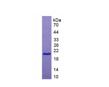 肿瘤坏死因子受体超家族成员7(TNFRSF7)重组蛋白,Recombinant Tumor Necrosis Factor Receptor Superfamily, Member 7 (TNFRSF7)