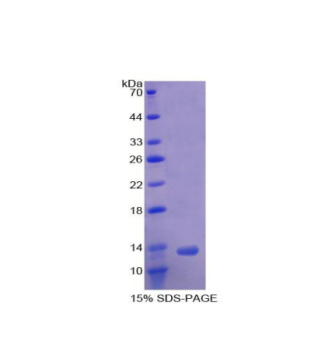 激活素A受体ⅠB(ACVR1B)重组蛋白,Recombinant Activin A Receptor Type I B (ACVR1B)