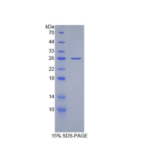 载脂蛋白B100(APOB100)重组蛋白,Recombinant Apolipoprotein B100 (APOB100)