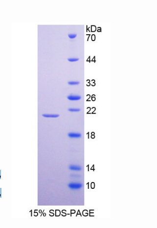 腫瘤壞死因子受體超家族成員4(TNFRSF4)重組蛋白,Recombinant Tumor Necrosis Factor Receptor Superfamily, Member 4 (TNFRSF4)