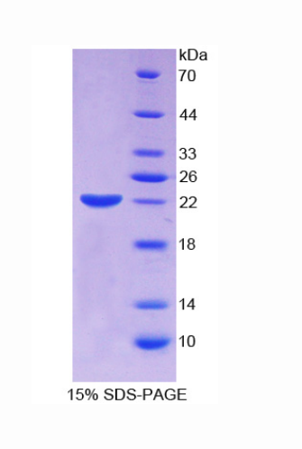 上皮细胞转化序列2(ECT2)重组蛋白,Recombinant Epithelial Cell Transforming Sequence 2 (ECT2)