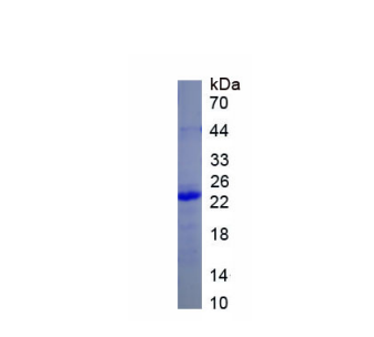 角蛋白23(KRT23)重组蛋白,Recombinant Keratin 23 (KRT23)