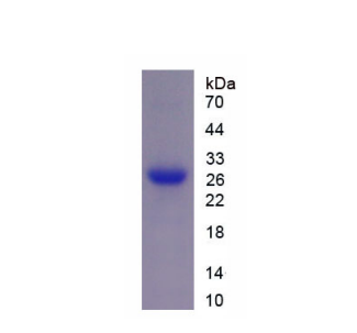 白介素2受体γ(IL2Rg)重组蛋白,Recombinant Interleukin 2 Receptor Gamma (IL2Rg)