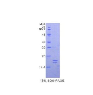 糖盏蛋白(GC)重组蛋白,Recombinant Glycocalicin (GC)