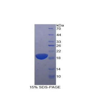 白介素11受體α(IL11Ra)重組蛋白,Recombinant Interleukin 11 Receptor Alpha (IL11Ra)