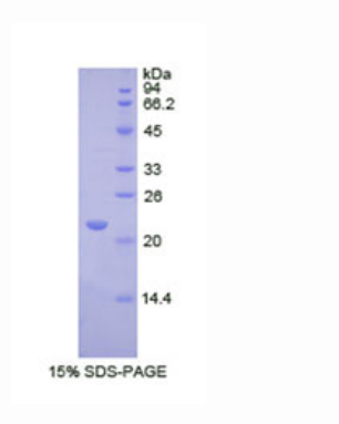 RNA核酸外切酶2同源物(REXO2)重组蛋白,Recombinant RNA Exonuclease 2 Homolog (REXO2)