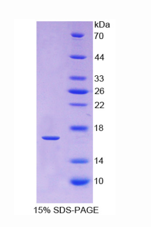 松弛素/胰岛素样肽受体1(RXFP1)重组蛋白,Recombinant Relaxin/Insulin Like Family Peptide Receptor 1 (RXFP1)