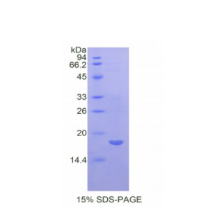 白介素17受體A(IL17RA)重組蛋白,Recombinant Interleukin 17 Receptor A (IL17RA)