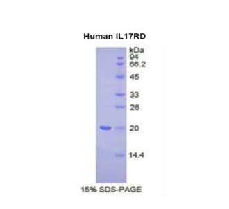 白介素17受体D(IL17RD)重组蛋白,Recombinant Interleukin 17 Receptor D (IL17RD)