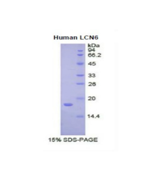 脂质运载蛋白6(LCN6)重组蛋白,Recombinant Lipocalin 6 (LCN6)