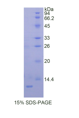 黑色素瘤優(yōu)先表達抗原(PRAME)重組蛋白,Recombinant Preferentially Expressed Antigen In Melanoma (PRAME)