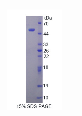 層粘連蛋白γ3(LAMC3)重組蛋白,Recombinant Laminin Gamma 3 (LAMC3)