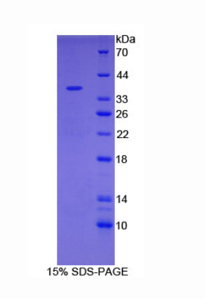 泛素羧基端酯酶L5(UCHL5)重組蛋白,Recombinant Ubiquitin Carboxyl Terminal Hydrolase L5 (UCHL5)