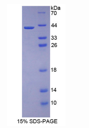 胎盤鈣黏蛋白(P-cadherin)重組蛋白,Recombinant Placental Cadherin (P-cadherin)