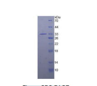 白介素1受体关联激酶2(IRAK2)重组蛋白,Recombinant Interleukin 1 Receptor Associated Kinase 2 (IRAK2)