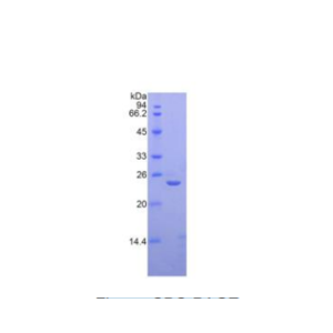 唾液酸结合Ig样凝集素12(SIGLEC12)重组蛋白