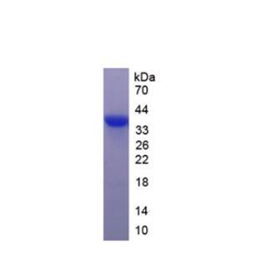 胰岛细胞自身抗原1(ICA1)重组蛋白