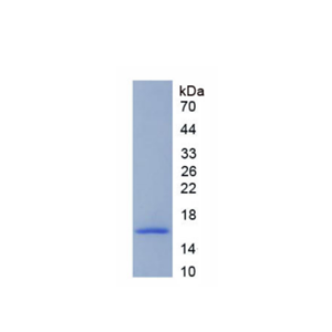 脱支酶同源物1(DBR1)重组蛋白