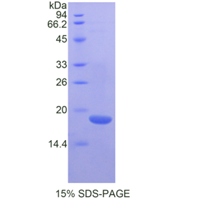 δ样蛋白1同源物(dLK1)重组蛋白