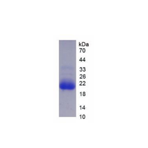 细胞色素P450家族成员3A7(CYP3A7)重组蛋白