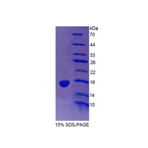 吲哚胺2,3-双加氧酶2(IDO2)重组蛋白