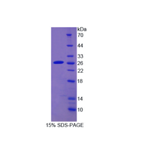 细胞色素P450家族成员2D6(CYP2D6)重组蛋白