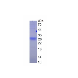 肿瘤坏死因子受体超家族成员17(TNFRSF17)重组蛋白