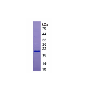 肿瘤坏死因子受体超家族成员7(TNFRSF7)重组蛋白,Recombinant Tumor Necrosis Factor Receptor Superfamily, Member 7 (TNFRSF7)