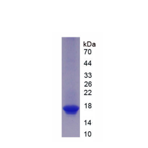 激活素A受体ⅡB(ACVR2B)重组蛋白