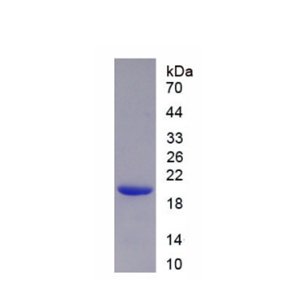 淋巴毒素β受体(LTbR)重组蛋白