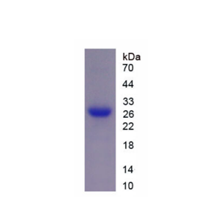 白介素2受体γ(IL2Rg)重组蛋白