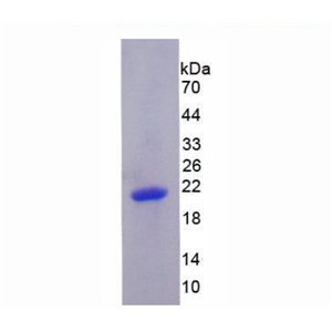 含PR域蛋白1(PRDM1)重组蛋白