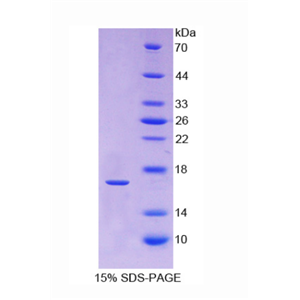松弛素/胰岛素样肽受体1(RXFP1)重组蛋白