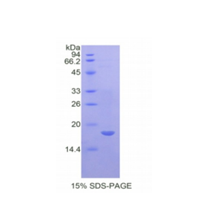 白介素17受体A(IL17RA)重组蛋白