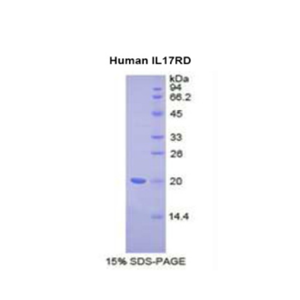 白介素17受体D(IL17RD)重组蛋白