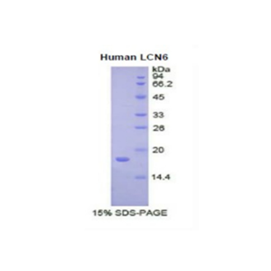 脂质运载蛋白6(LCN6)重组蛋白,Recombinant Lipocalin 6 (LCN6)