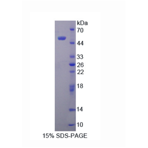 层粘连蛋白γ3(LAMC3)重组蛋白,Recombinant Laminin Gamma 3 (LAMC3)