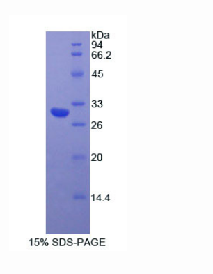 肌球蛋白ⅠA(MYO1A)重组蛋白,Recombinant Myosin IA (MYO1A)