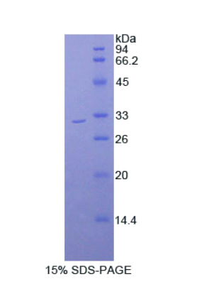 肌球蛋白ⅠB(MYO1B)重组蛋白,Recombinant Myosin IB (MYO1B)